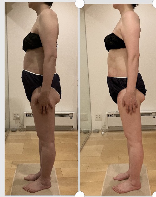 infinito_
				BodyWrap6