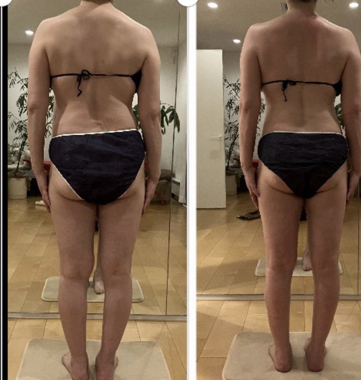 infinito_
				BodyWrap7