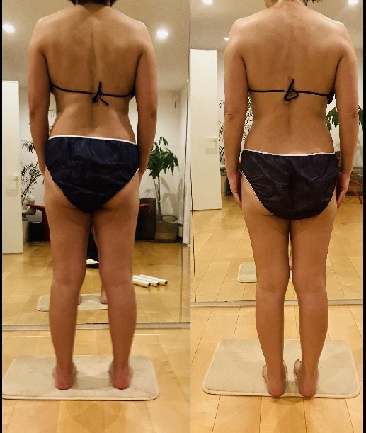 infinito_
				BodyWrap5